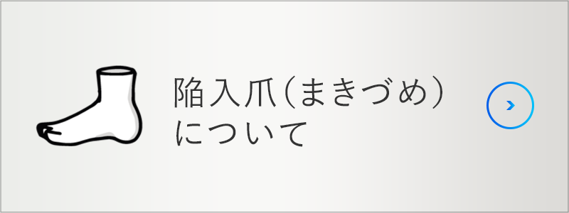 陥入爪（まきづめ） ）について