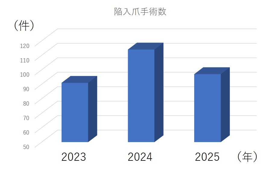 陥入爪手術数